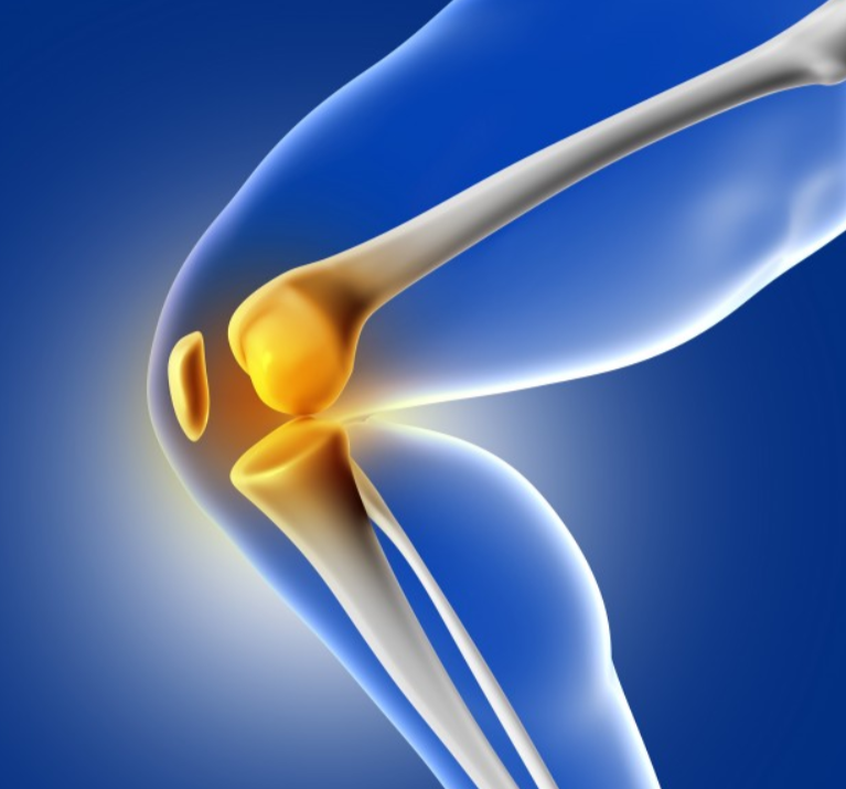 Knee Replacement