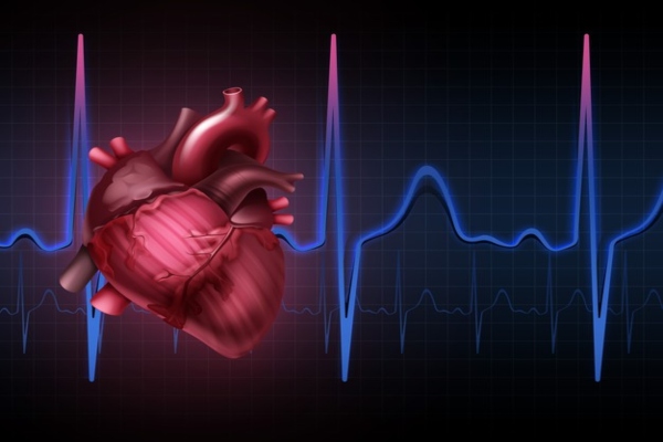 coronary artery disease