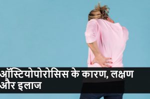 osteoporosis reasons symptoms and treatment