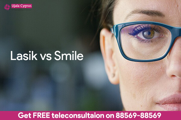 lasik vs smile