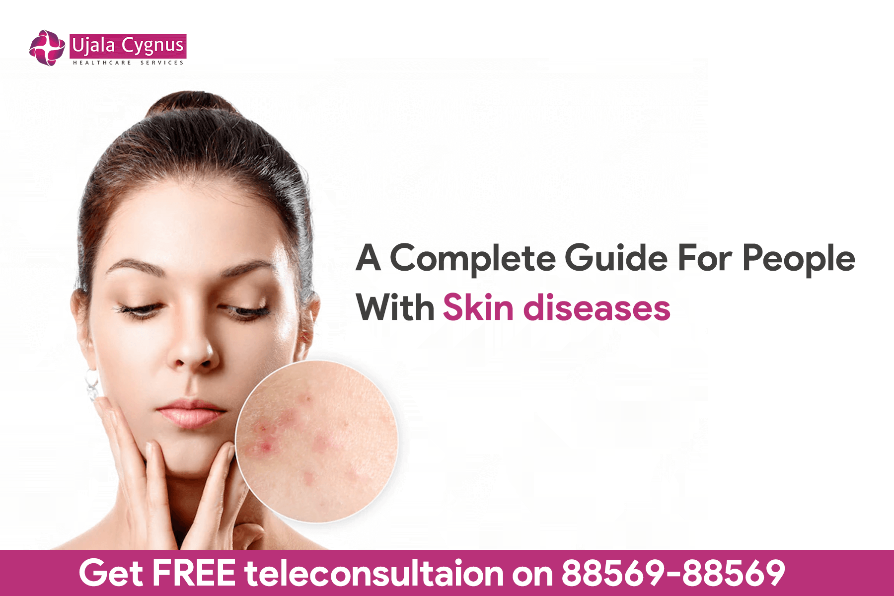 A Complete Guide For People With Skin diseases