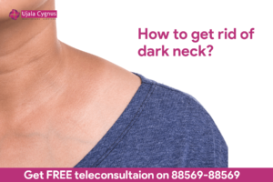 how to get rid of dark neck?